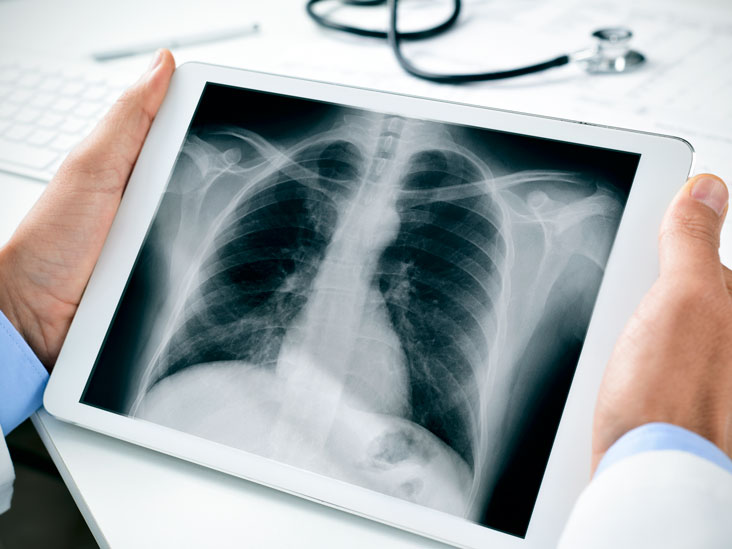 مقدار fluorography صالح